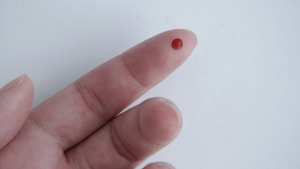 Finger prick blood test